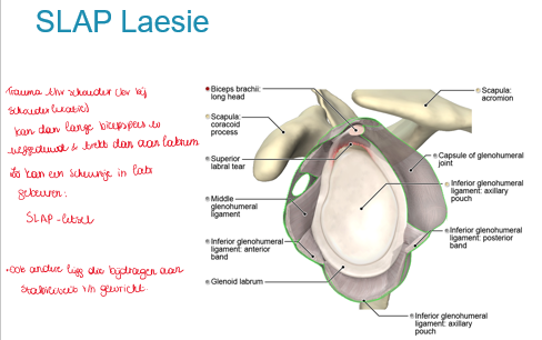 <p>superior labrum from anterior to posterior</p><p>SLAP laesie</p>