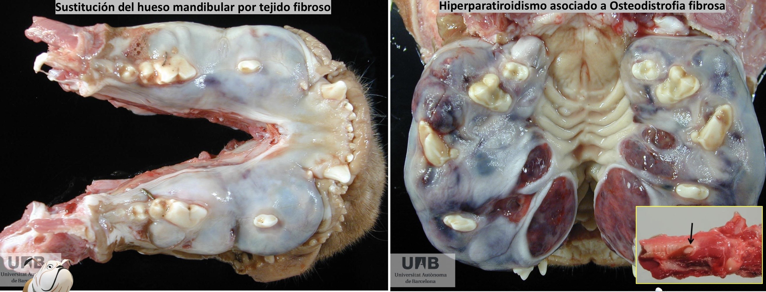 <p>Patogenia </p>