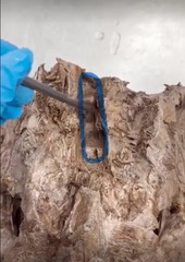<p>Name the ligament</p>