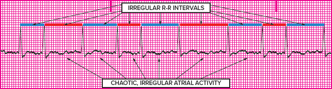<p>Which rhythm is this?</p>