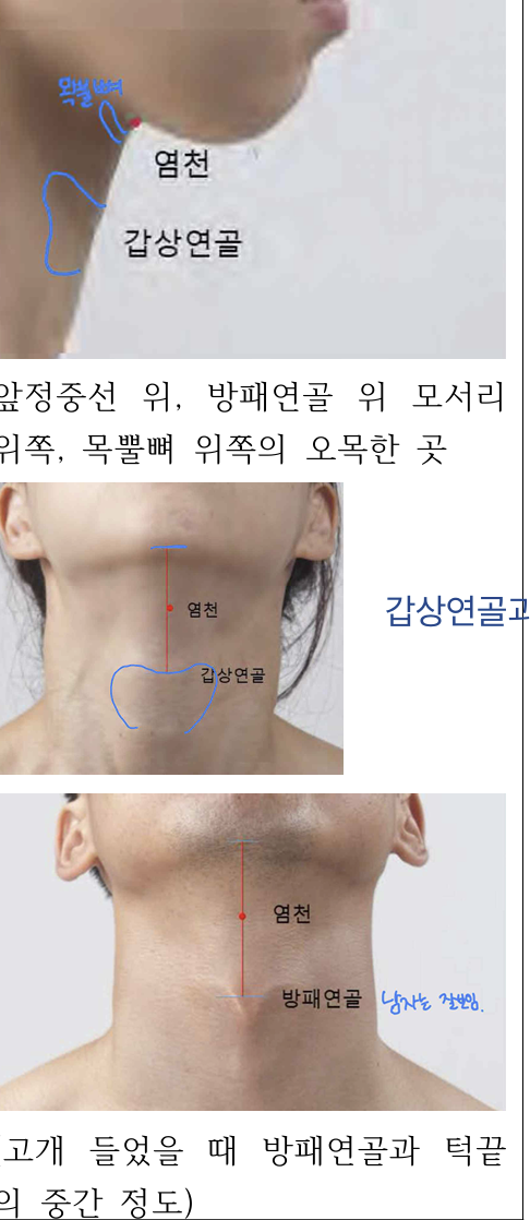 <p>방패연골 위 모서리 위쪽, 목뿔뼈 위의 오목한 곳 (방패연골과 턱끝 중점)</p>