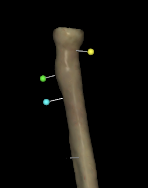<p>What is the yellow tag of the right radius?</p>