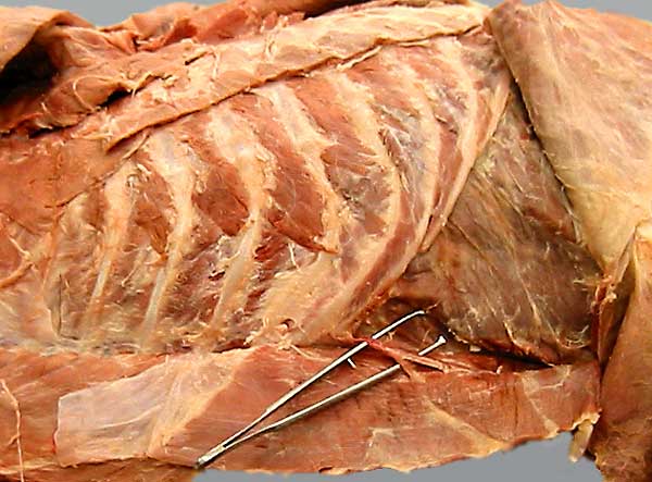 <p>Muscles between the ribs</p>