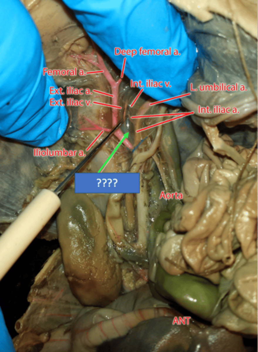 <p>receives blood from the internal and external iliac veins and returns blood to the inferior vena cava</p>