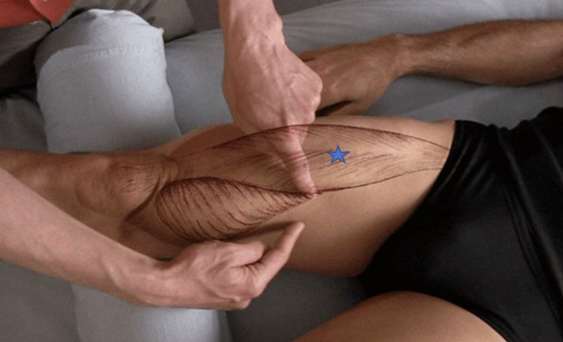 <p><span>From the list of muscles and actions below, identify the "starred" muscle and its primary actions.</span></p>