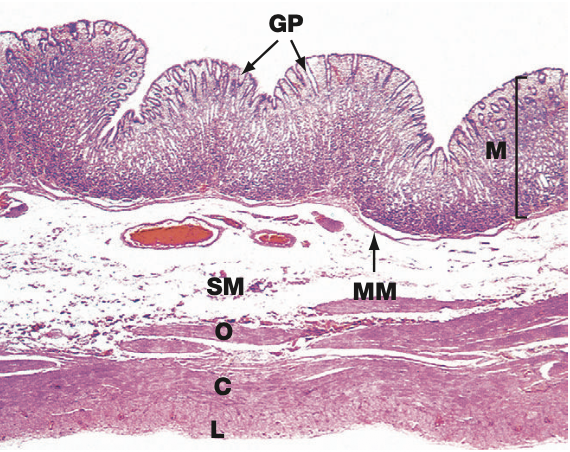 <p>What area of the stomach is this?</p>