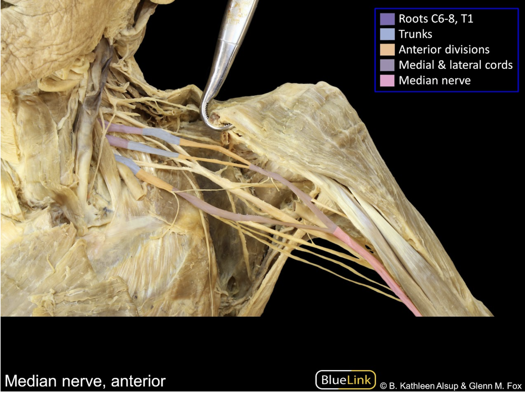 <p>Branches from medial/lateral cords. Nerve falls above/on top of the axillary nerve. The medial nerve is the center portion of letter M: /<strong>|</strong>\</p>