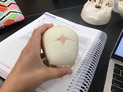 <p>What is the largest soft spot on fetal skull(baby)</p>