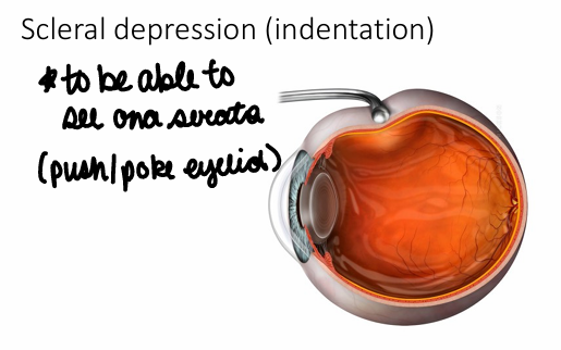 <p>Ora serrata; could do a scleral depression (indentation) this is when you push/poke the eyeball</p>