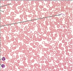 <p>Blood C.T.</p>