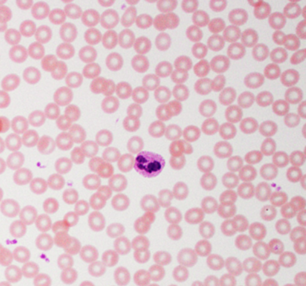 <p>ID white blood cells</p>