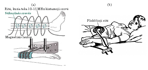 <p>gydymo metodas, kai audiniai veikiami <strong>aukšto dažnio kintamu magnetiniu lauku</strong></p>