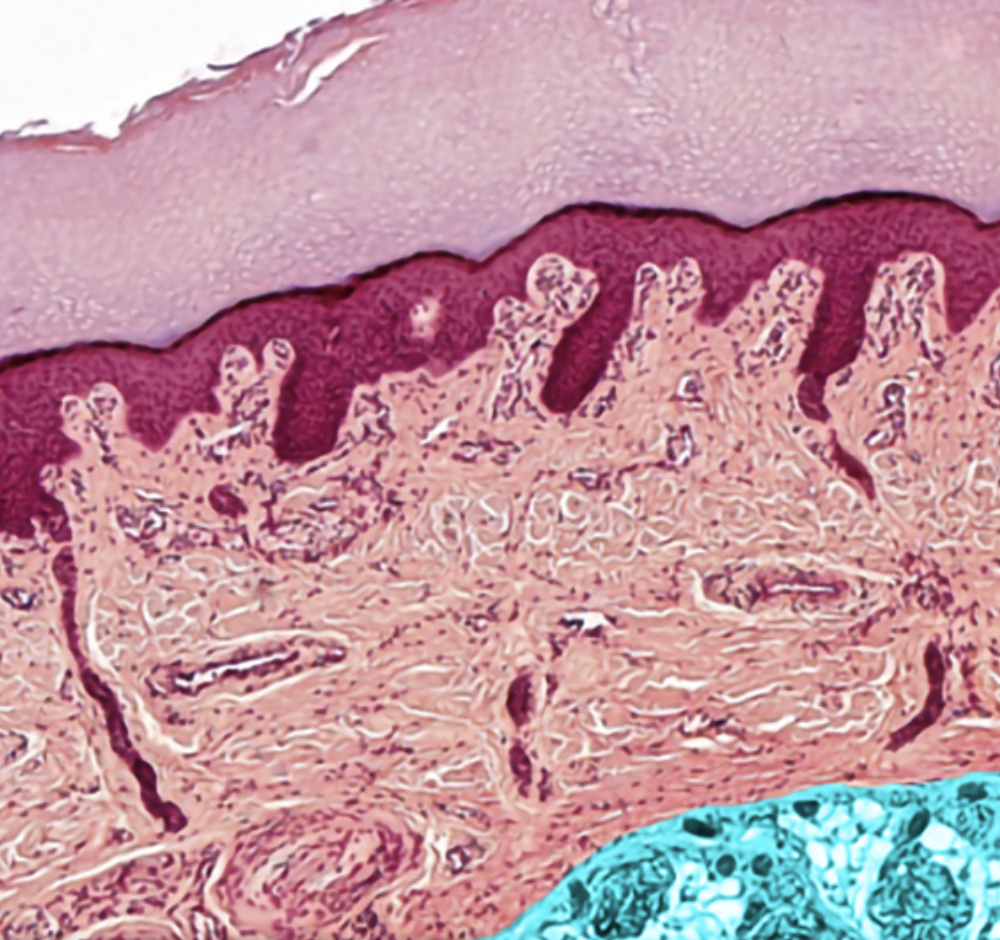 term image