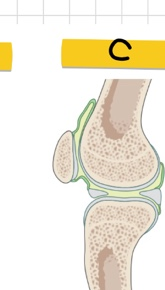 <p>C</p>