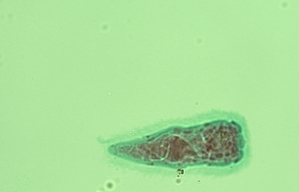 <p>What helminth/fluke/parasitic worm is this?</p>