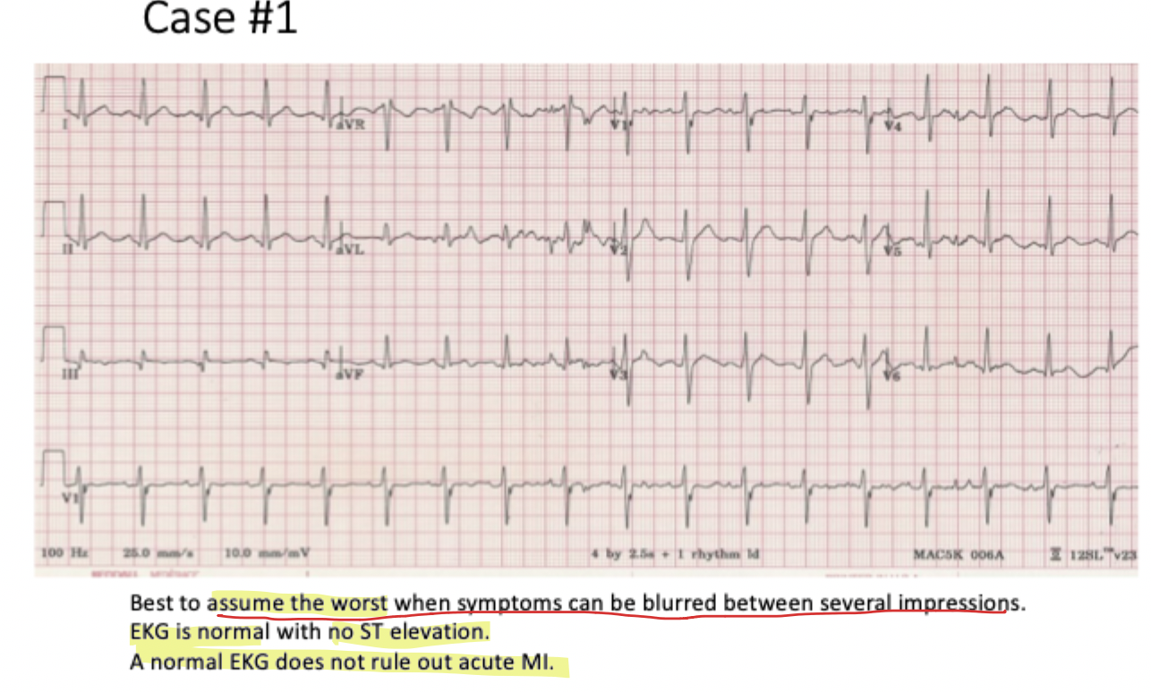 <p>The clinician <strong>must 'assume the worst</strong>' because <strong>cardiac symptoms often mimic gastric issues</strong> like <em>indigestion</em><br><br><span><strong>What Happens:</strong> A 52-year-old reports indigestion after a heavy meal. Vital signs show mild tachycardia (P=108), but the <strong>ECG is normal</strong> with <em>no ST elevation.</em></span></p><ul><li><p><span><strong>Logic:</strong> Clinicians must "assume the worst" because cardiac symptoms often mimic gastrointestinal issues like indigestion.</span></p></li><li><p><span><strong>Association:</strong> It is critical to remember that <strong>a normal ECG does not rule out an acute MI</strong>, especially if the patient is symptomatic.</span></p></li></ul><p></p>