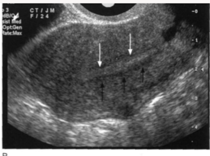 <p>Identify the endometrial phase</p>
