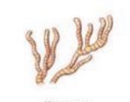 <p>What streptomyces spore-bearing structure is this?</p>