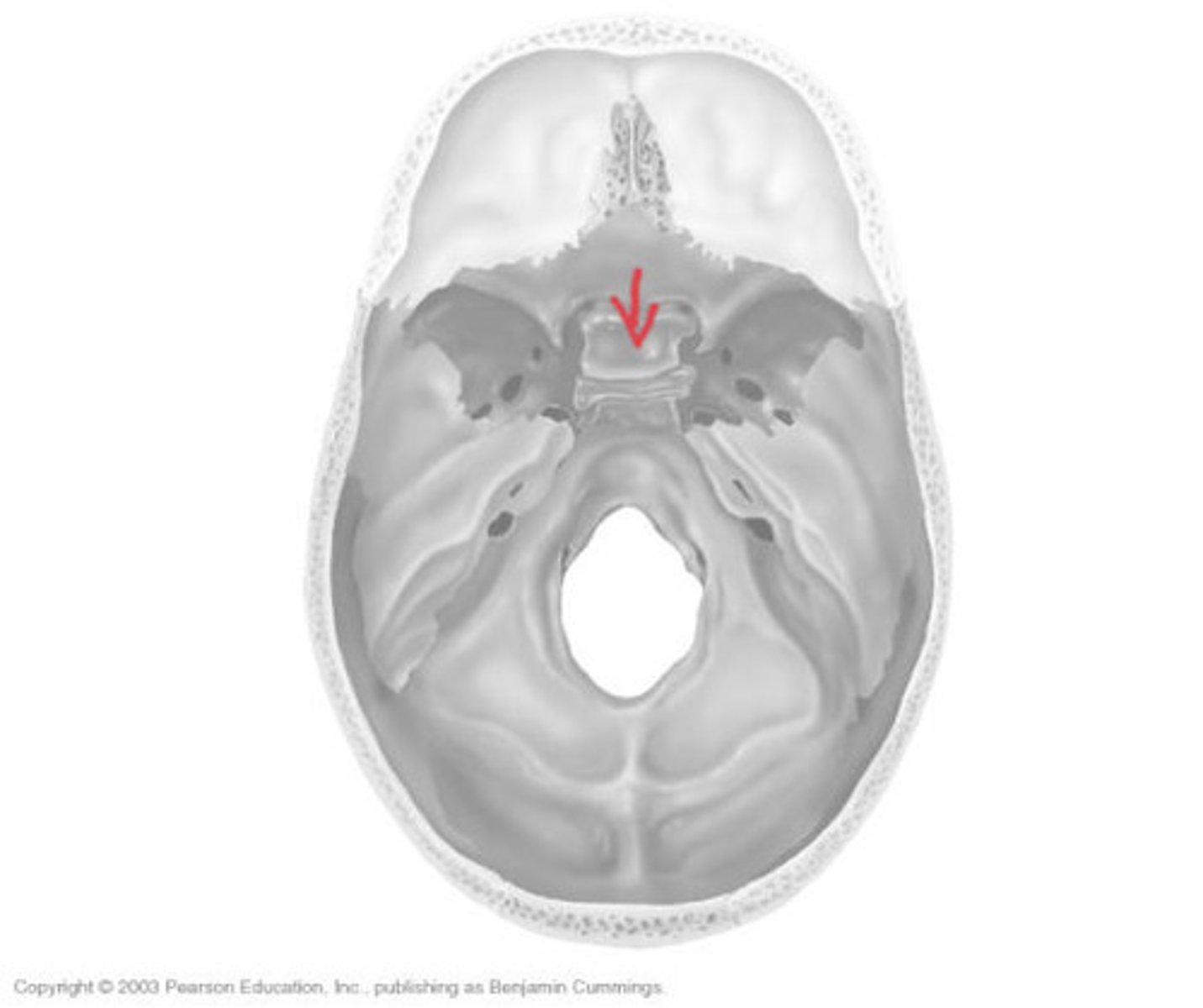 <p>ID structure at arrow</p>