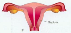<p>one body but internal septum</p>