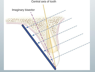 <p>-central ray is directed at a right angle to the imaginary plane that bisects the angle formed by the image receptor and the central axis of the object</p><p>-does not use principles of projection geometry, so there is a lot of image distortion</p>