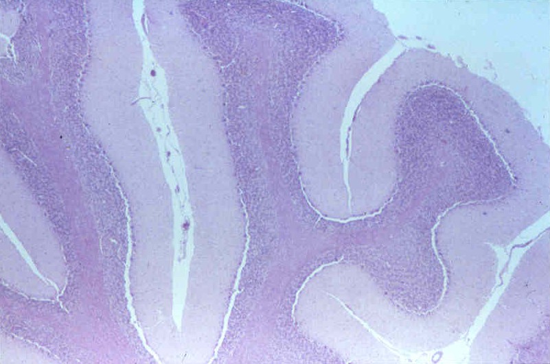 <p>Label each - grey vs. white matter</p>