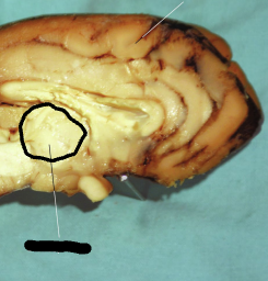 <p>• An area of the brain that serves as a nervous system passageway between the brainstem and the cerebrum • Not well-defined physically </p><p>• Important structures: </p><p>Thalamus</p><p>Hypothalamus</p><p>Pituitary gland</p><p>Pineal gland</p>