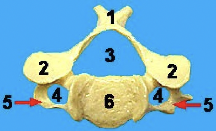 <p>what vertebra is this and what view</p>