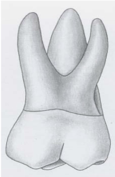 <p>How is the facial anatomy of the maxillary first molar?</p>