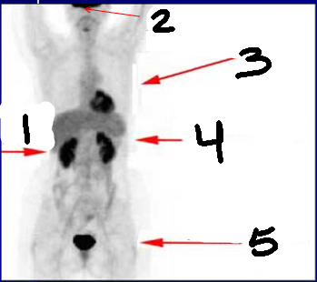 <p>what is 1?</p>
