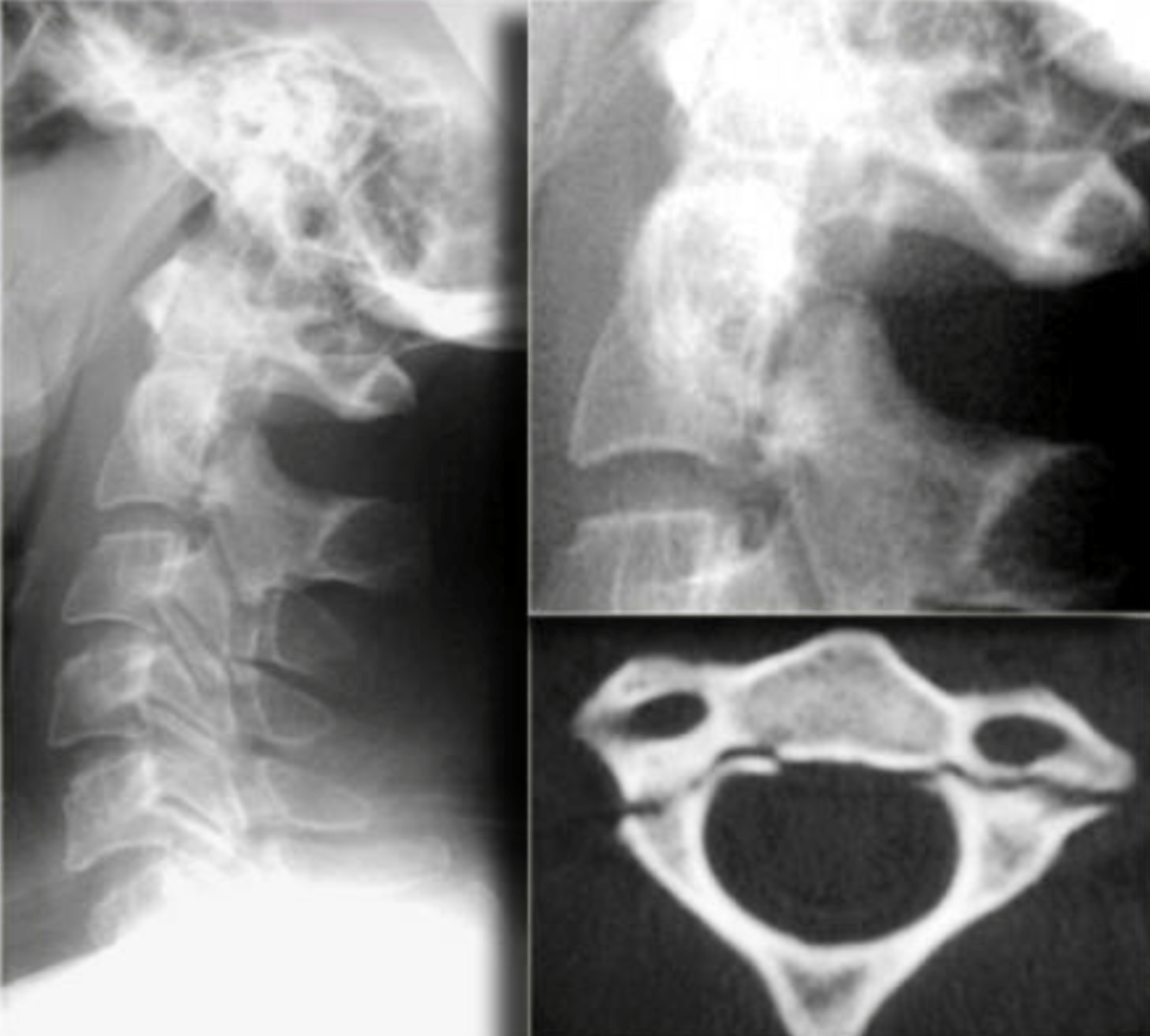 <p>What is the diagnosis?</p>