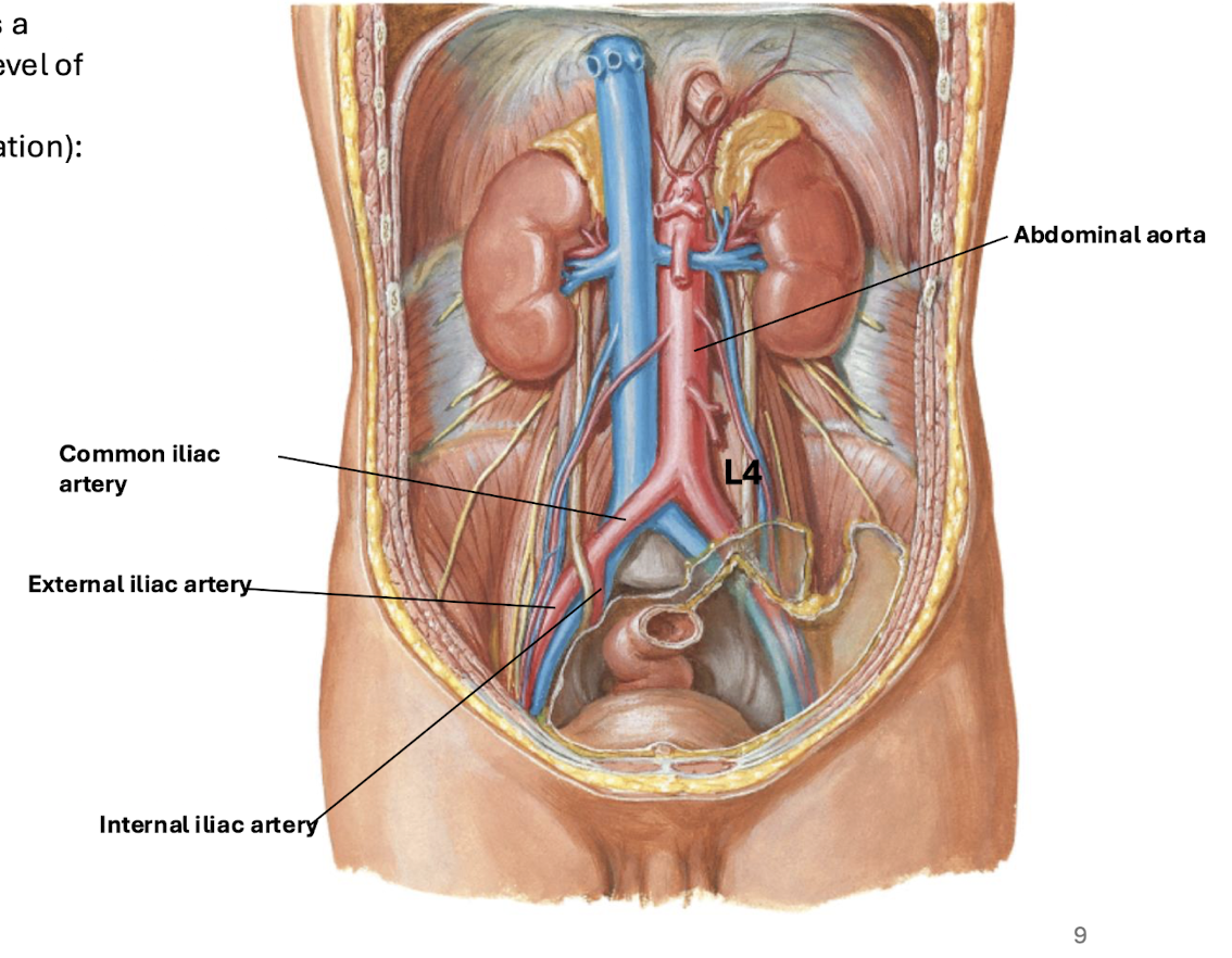 <p>blue - IVC<br>pink - abdominal aorta<br>seafoam heart - lumbar arteries <em>(posterior </em><span><em>segmental vessels of the abdominal aorta)</em></span><br>yellow - common iliac artery<br>red - internal iliac artery<br>baby blue - external iliac arte</p>