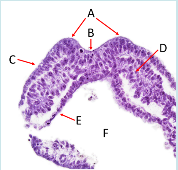 <ol><li><p>Label A, B. C, D, E and F</p></li><li><p>What embryonic structure does F open into?</p></li><li><p>What view is this?</p></li></ol><p></p>