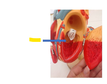 <p>What is the yellow arrow?</p>
