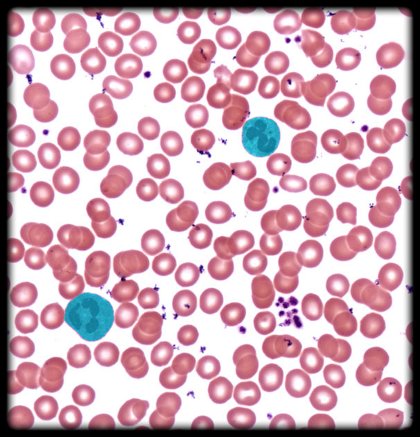 <p>Neutrophil <span>(Blood Peripheral Smear)</span></p>