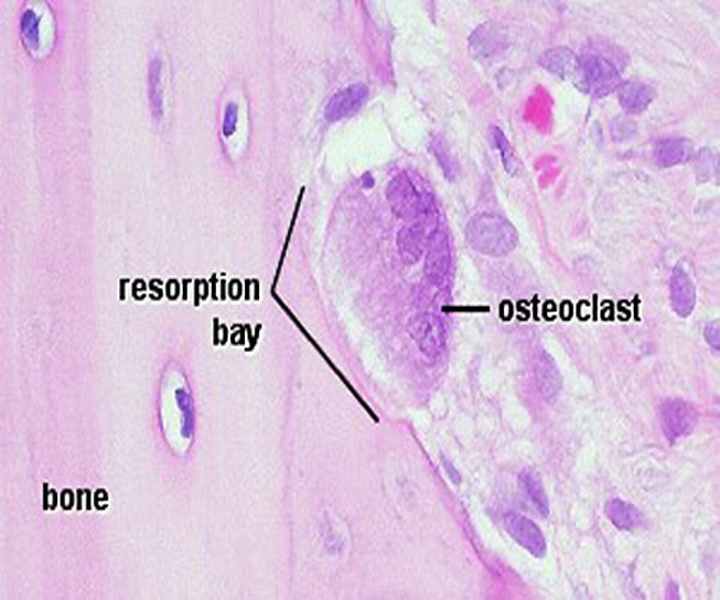 <p>Osteoclasts</p>