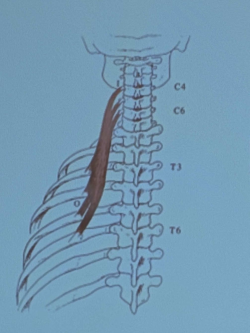 <p>Muscle name?</p>