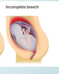 <p>Butt first with one leg down and one leg up</p>