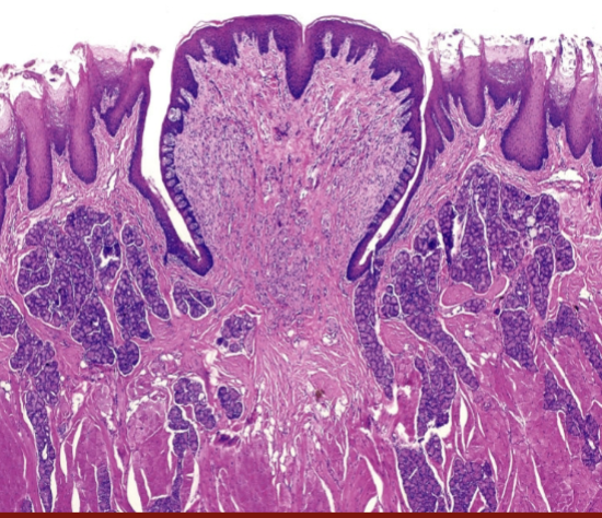 <p>What is this tissue from?</p>