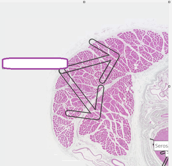 <p>spermatic cord</p>