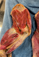 <p>Identify the muscle</p>