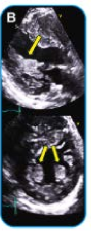 <p>what does this image show?</p>
