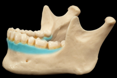 <p>Ridge of the mandible containing the tooth sockets</p>