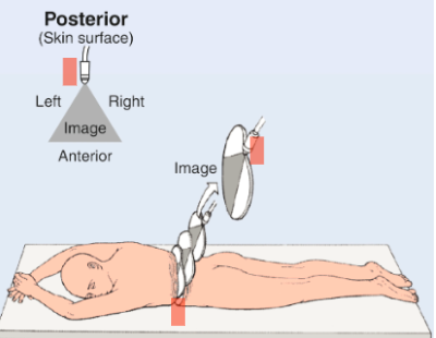 <p>Laying on belly (not frequently used for US)</p><p>Indicator towards machine (patient’s left)</p>
