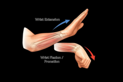 <p>Between the two heads of the pronator teres muscle.</p>