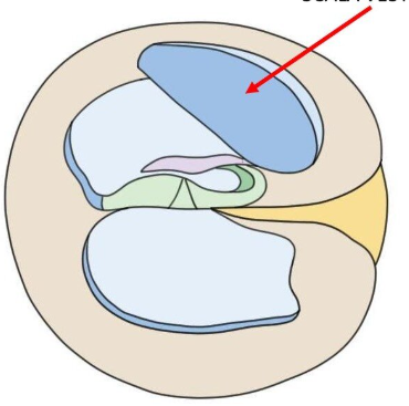 <p><br></p><p><span style="background-color: transparent;">Chamber of the cochlea that is superior to the cochlear duct. </span></p>
