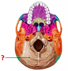 <p>Identify this bone.</p>