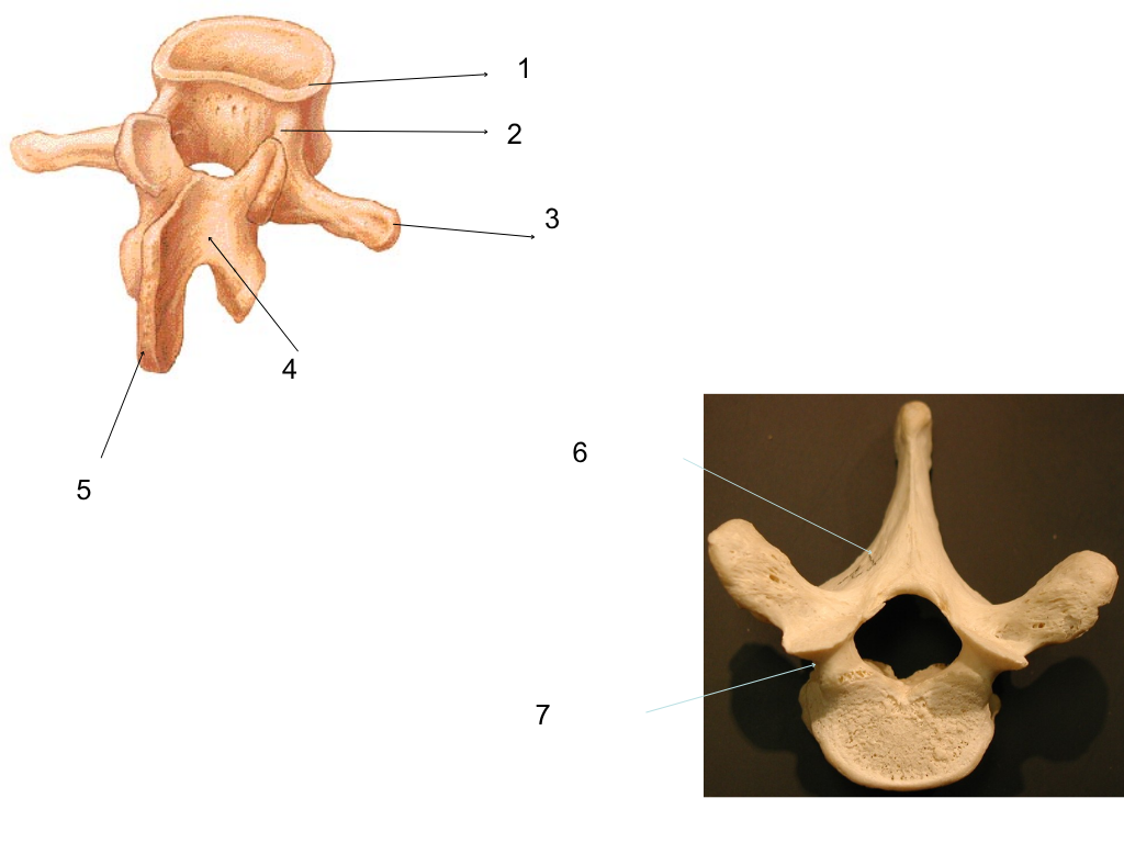 <p>what is #5 pointing at?</p>