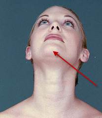 <p>the chin</p>