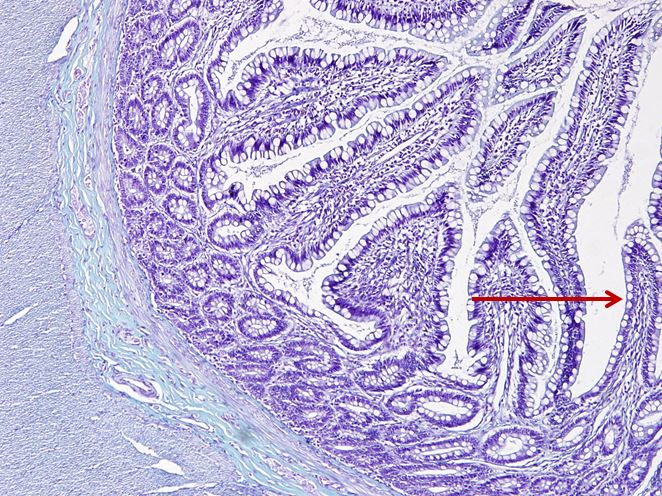 <p>Biểu mô gì ?</p>